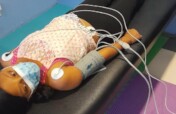 Specialist medical treatment for community member