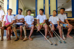 Prosthetics Clinic
