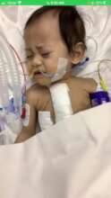 Baby Noor in recovery room after surgery