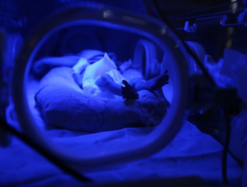 Help to cure newborns from jaundice in Kazakhstan