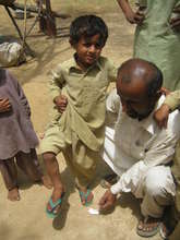 Child showing water borne disease