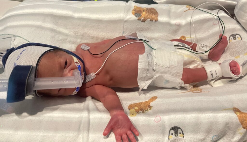 Mercy Health Neonatal Services