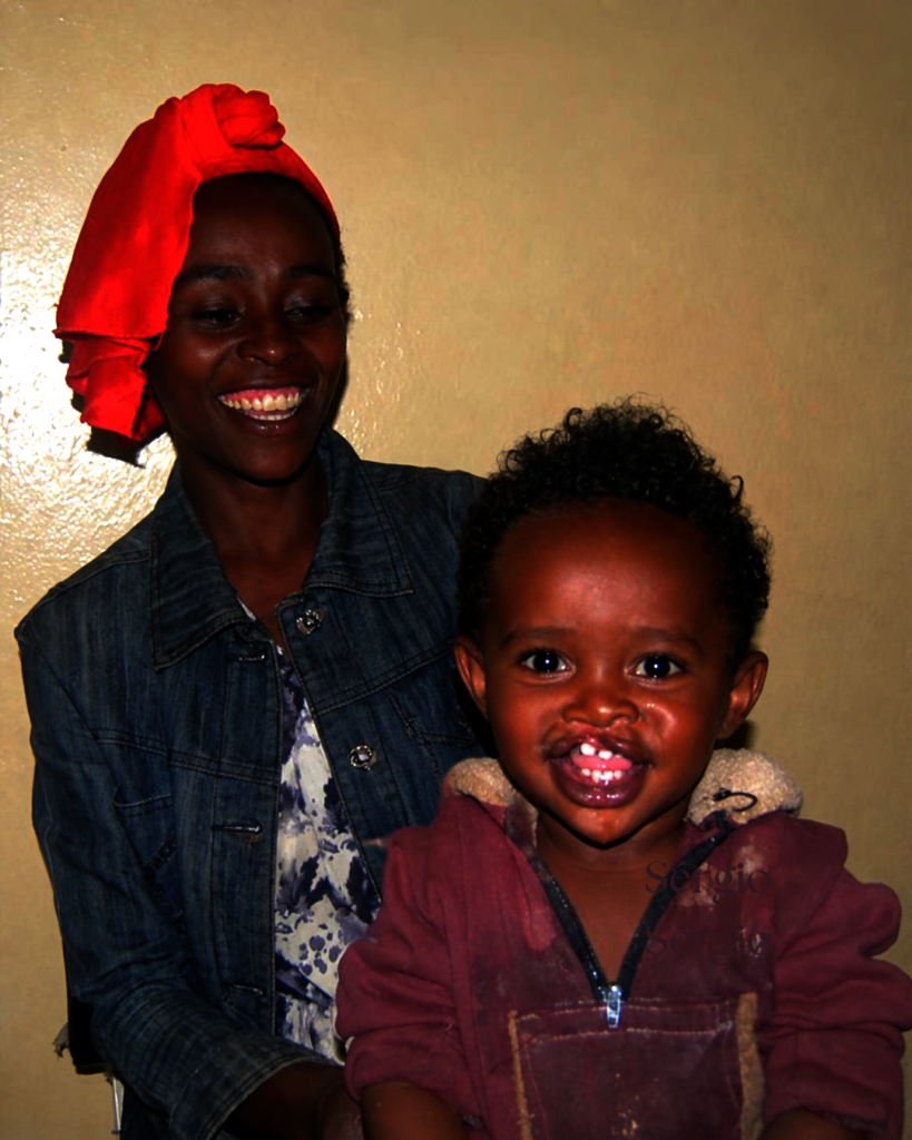 Fedhasa and his mother before his surgery.