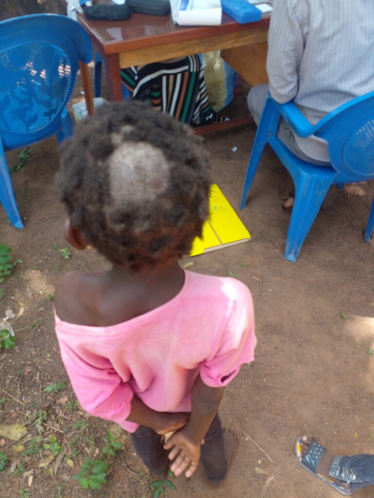 Support hospital bills for needy children in Ghana