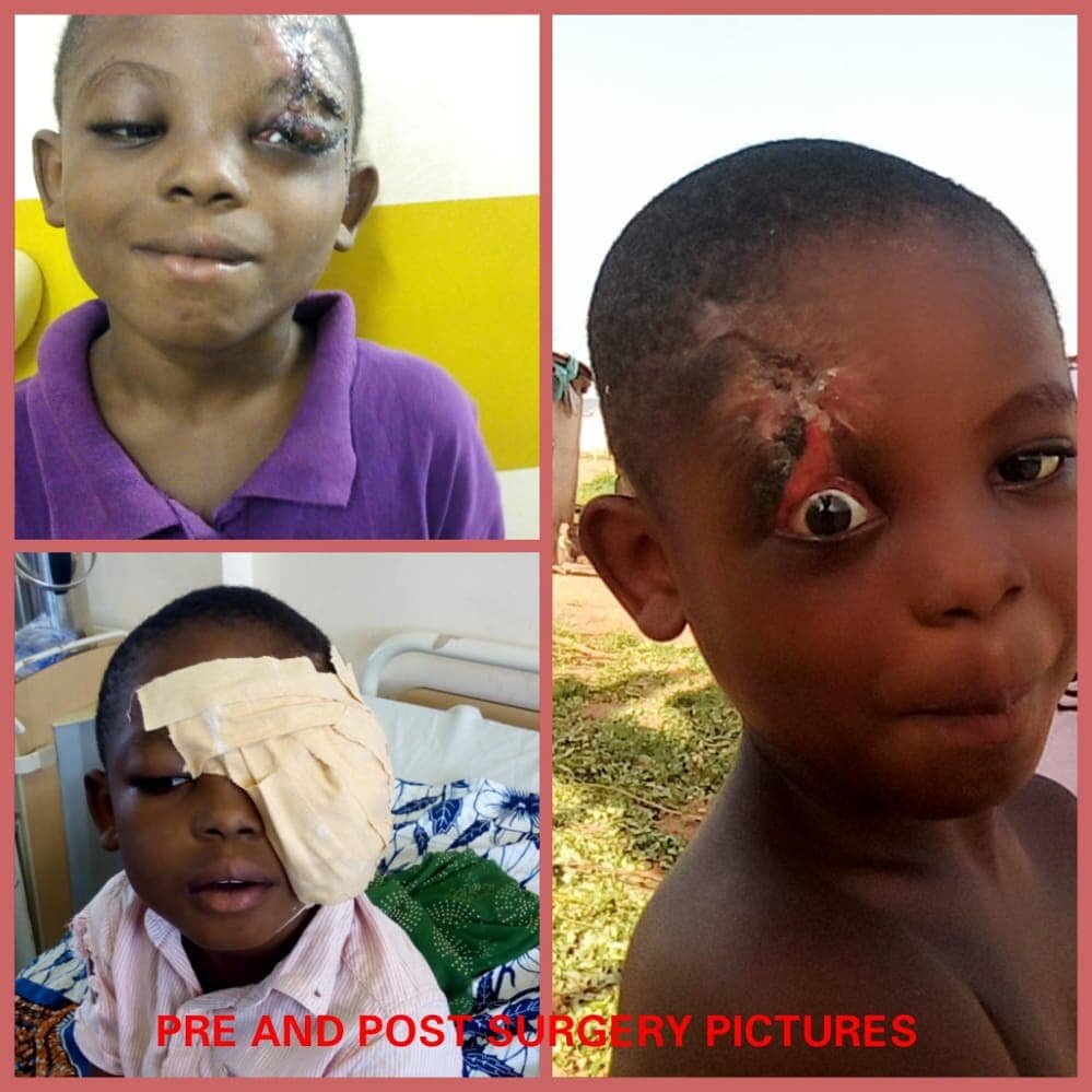 Support hospital bills for needy children in Ghana