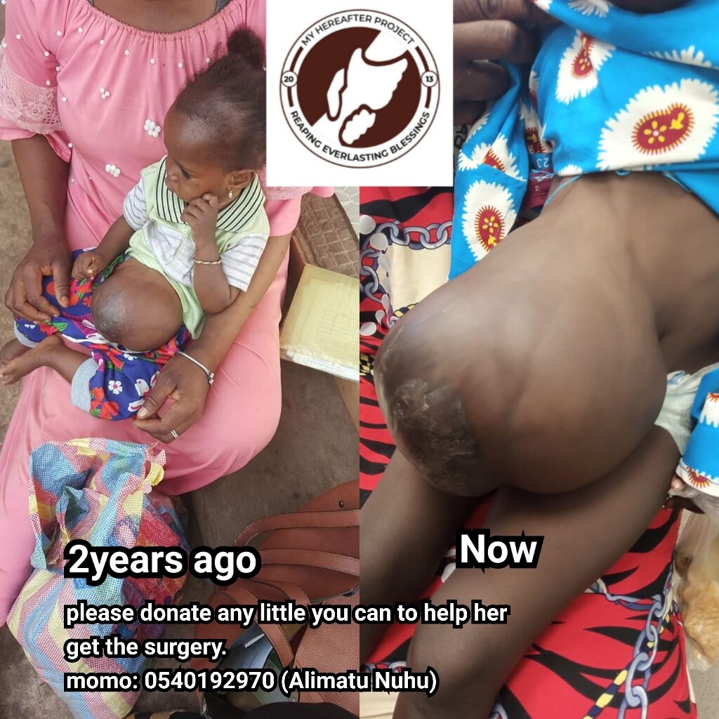 Support hospital bills for needy children in Ghana