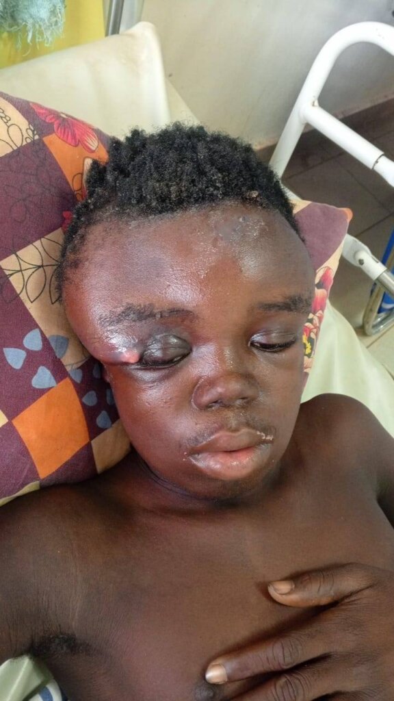 Support Patient Rescue Fund for Vulnerable Familis