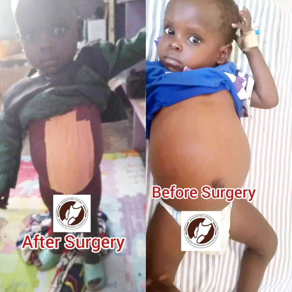 Support Patient Rescue Fund for Vulnerable Familis