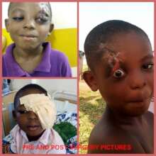 Ismael after surgery