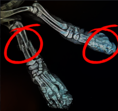 xray of Nouri's legs