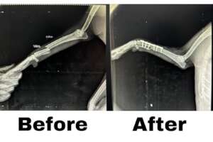 X-ray taken Before and after the Surgery