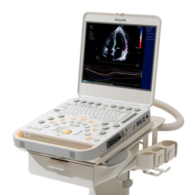Philips CX50 2015 Portable Ultrasound Scanner Mach