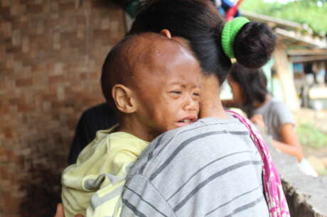 Save Malnourished Children in Rural Indonesia