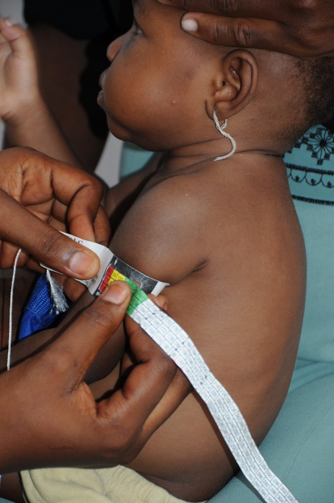 Treat and Prevent Malnutrition in Haiti