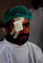 Barkat post cataract surgery