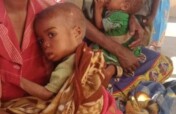 Support for children affected by malnutrition