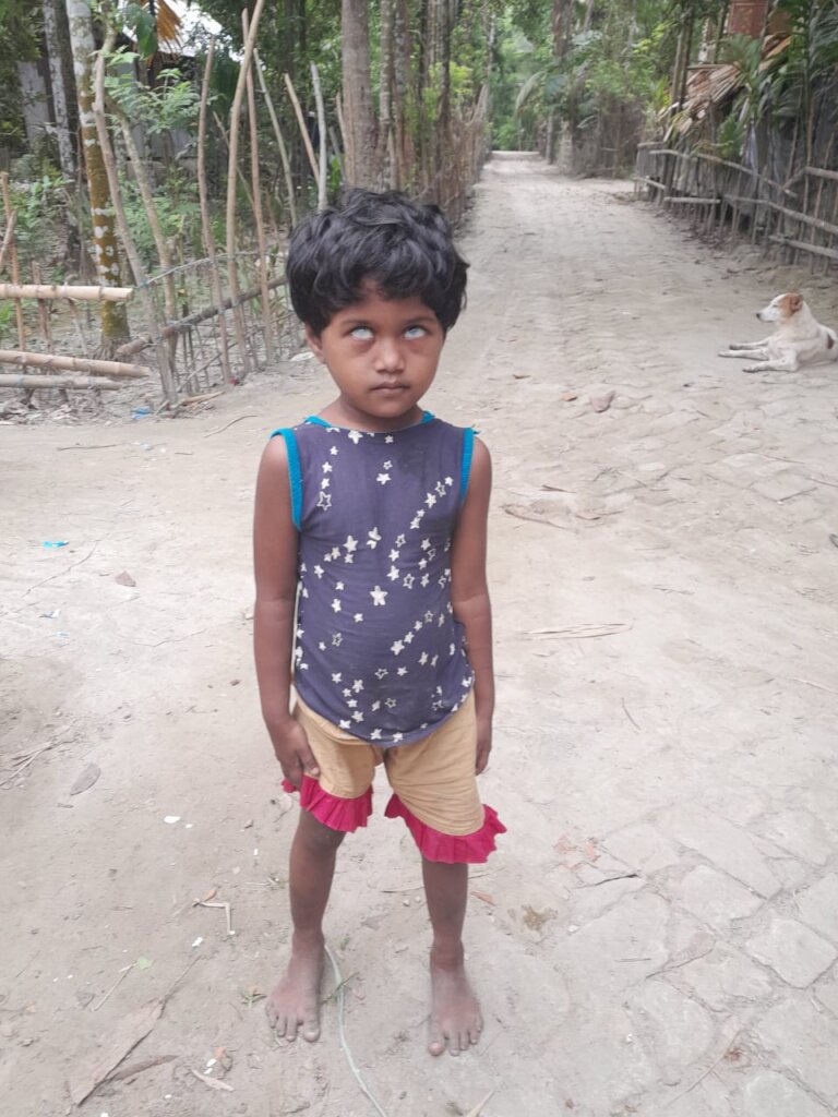 Sight for 5,000 Poor Blind Children in Bangladesh