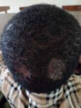 Tunu's Head before our intervention
