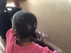 Sickness from unsafe and unclean living conditions