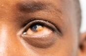 Help JuJu See Again