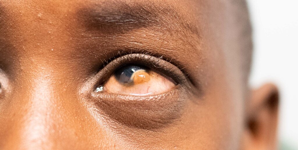 Help JuJu See Again