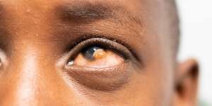 Help JuJu See Again