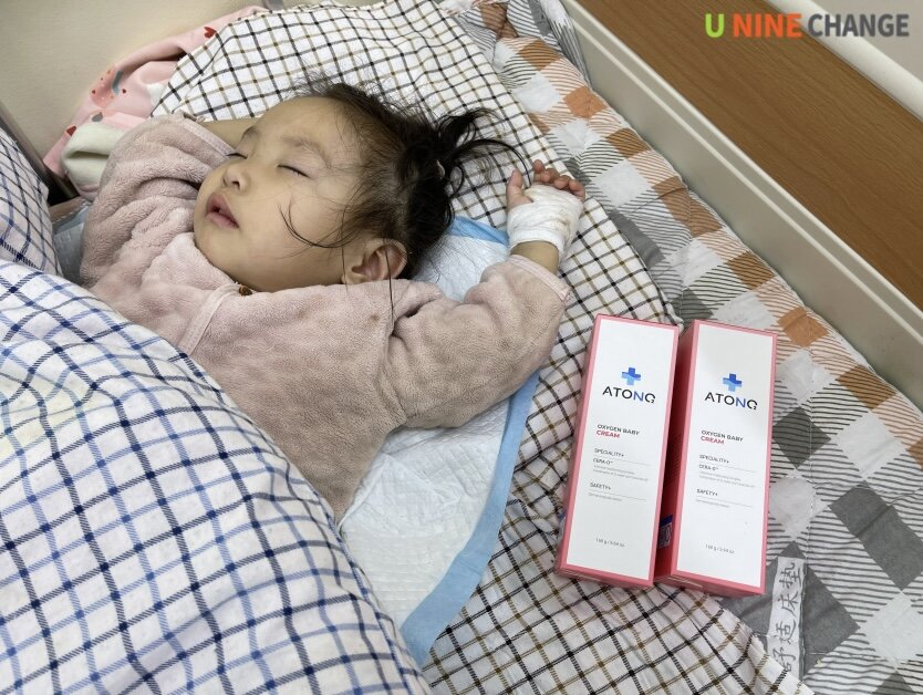 Treatment support for burn children in Mongolia