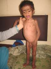 Children infected or affected by HIV