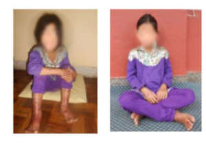 Bindu Before and After