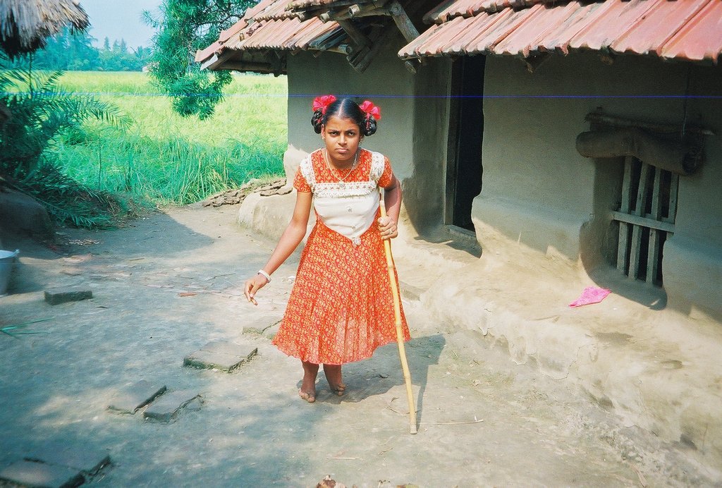 Send 100 disabled children to schooling in India