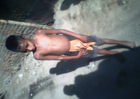 Send 100 disabled children to schooling in India