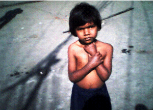 A mentally challenged child