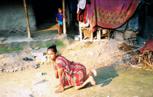 Locomotor disabled girls