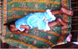 A cerebral palsy child