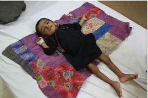 Child in pediatric ward