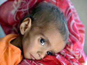 Baloch Poor and Orphan