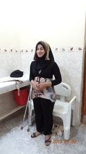 Ms Hassan standing on her new leg for the 1st time