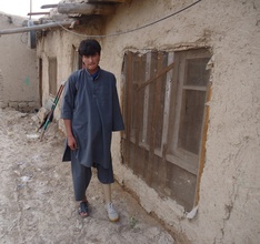 Akhter with his new leg!