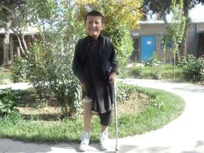 Essamudin smiling after receiving his new leg