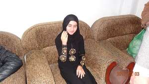 Young woman recently fitted with a prosthetic hand
