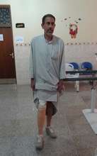 Iraqi man being fitted with a new leg