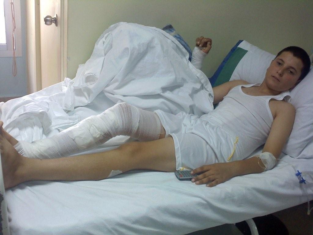 Help a Landmine Victim Walk Again