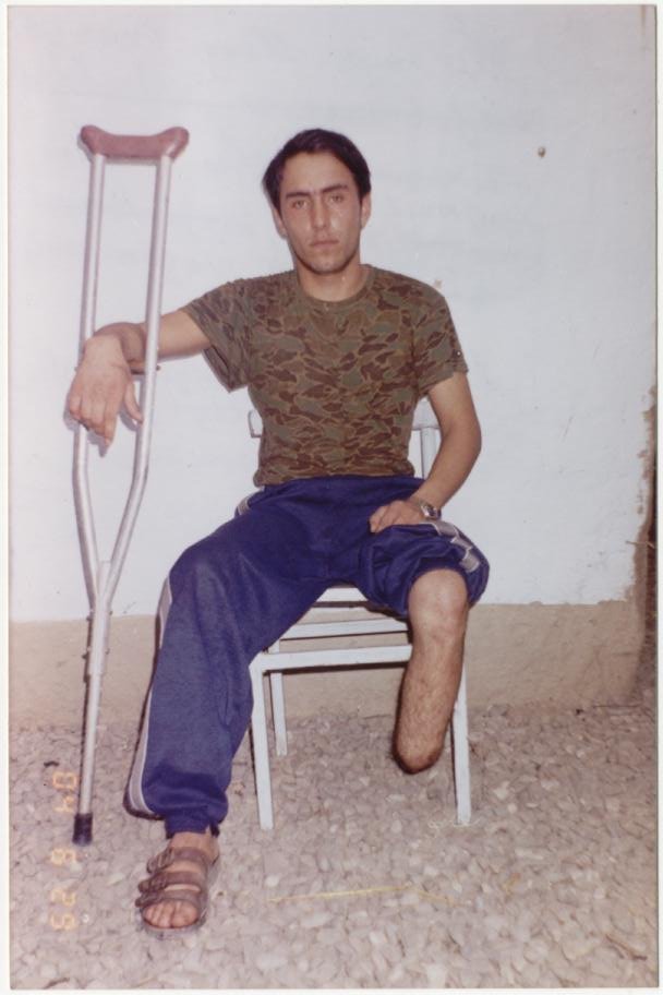 Help a Landmine Victim Walk Again