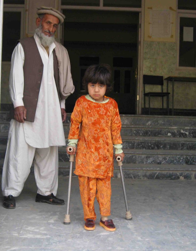 Help a Landmine Victim Walk Again