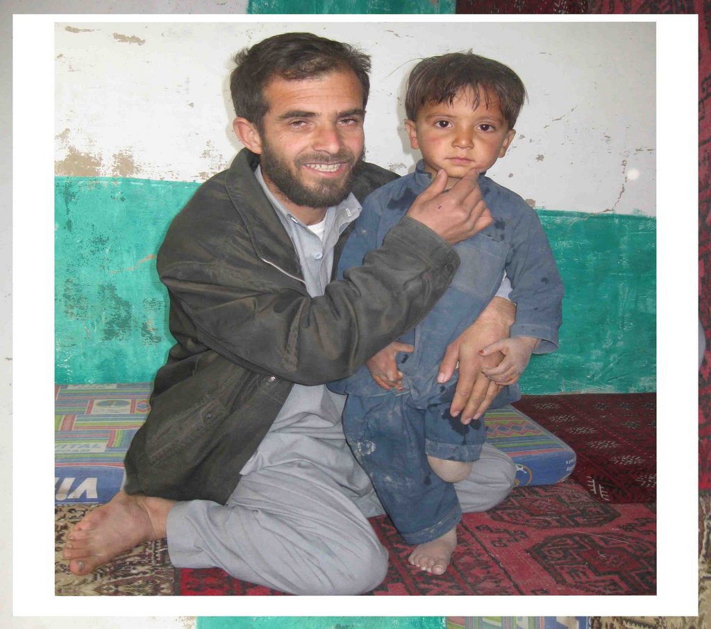 Help a Landmine Victim Walk Again