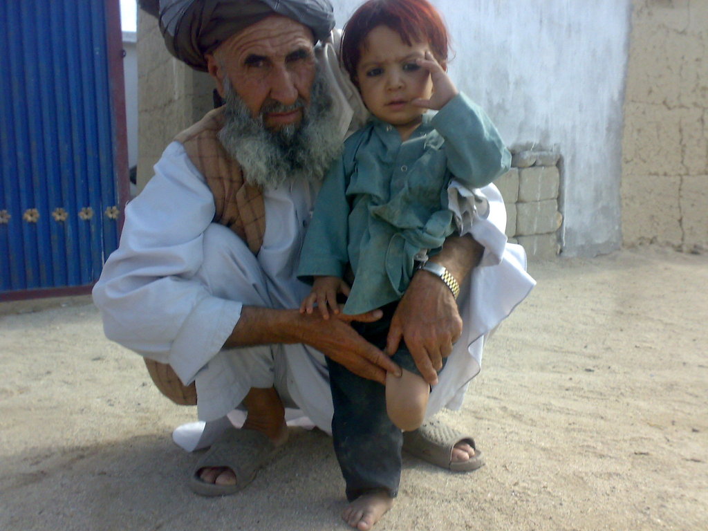 Help a Landmine Victim Walk Again