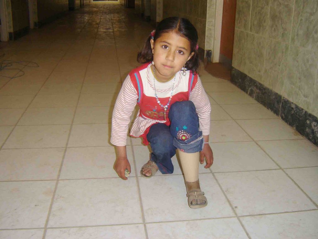 Help a Landmine Victim Walk Again