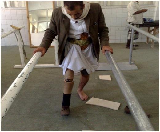 Help a Landmine Victim Walk Again