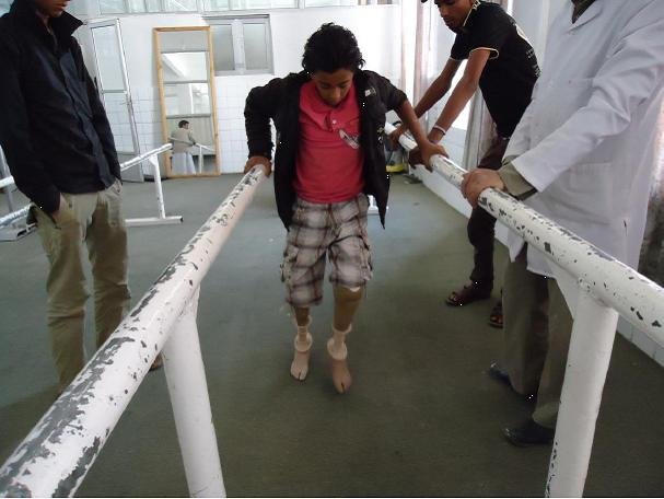 Help a Landmine Victim Walk Again