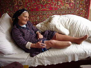 A 62 year old Afghan woman who lost her leg